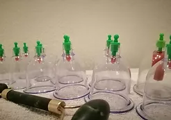 eutopia wellness center thesalloniki cupping massage